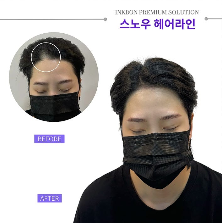 두피문신 작업